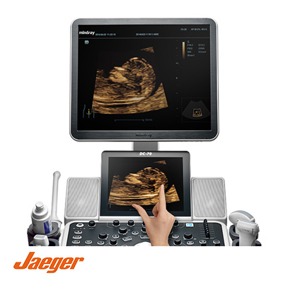 ultrasonido-4D-elastografia-mama-cancer-ginecologia-jaeger